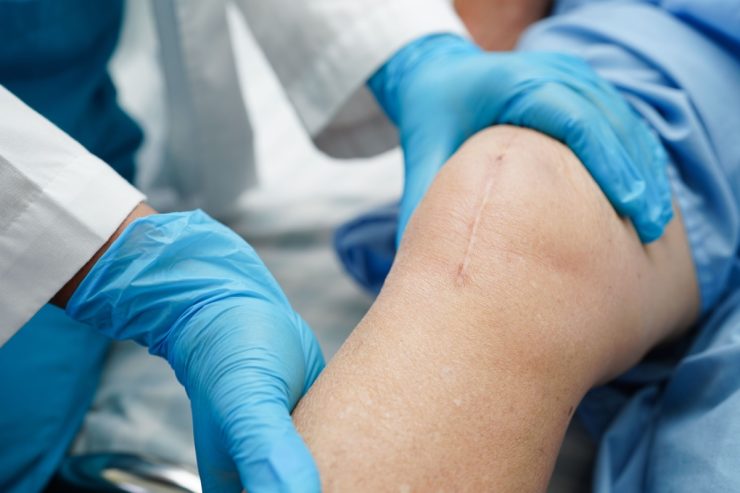 How-Do-New-Medical-Technologies-Help-Wounds-Heal-Faster